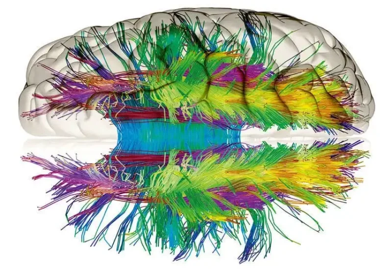 Comprensione delle reti neurali artificiali