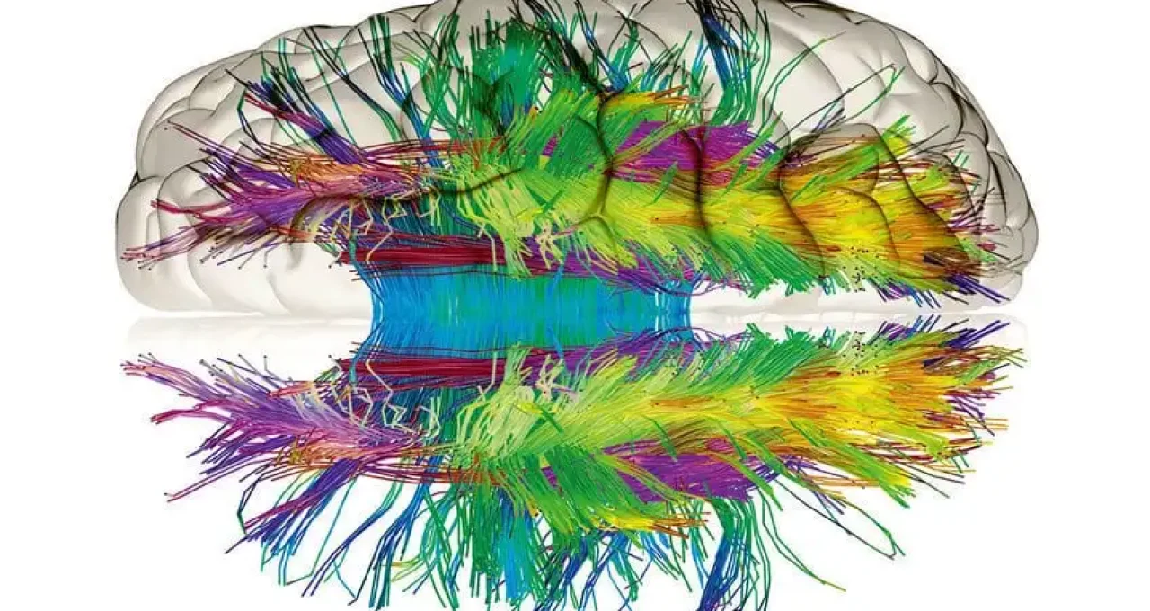 Comprensione delle reti neurali artificiali